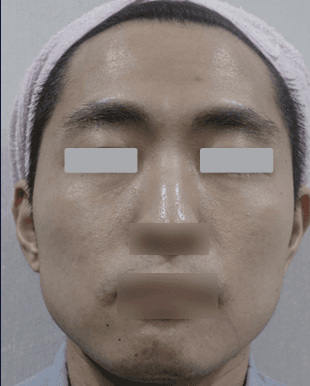 Clinical Case Position 1