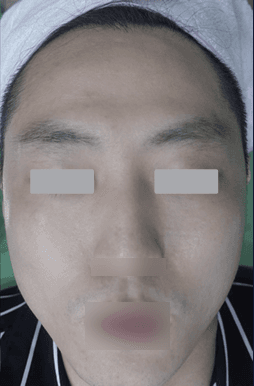Clinical Case Position 3