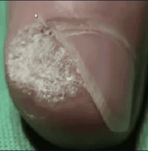 Clinical Case - Before