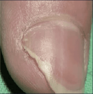 Clinical Case - After